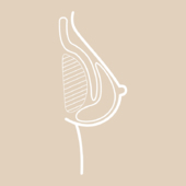 Implantat im oberen Bereich vom Brustmuskel, im unteren Bereich von Brustdrüse bedeckt