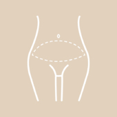 Bauchdeckenstraffung mit alleiniger horizontaler Narbe